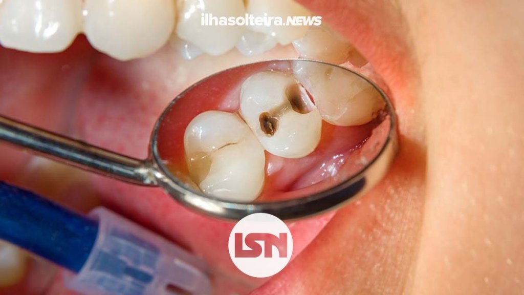 carie-gou-ilha-solteira-news