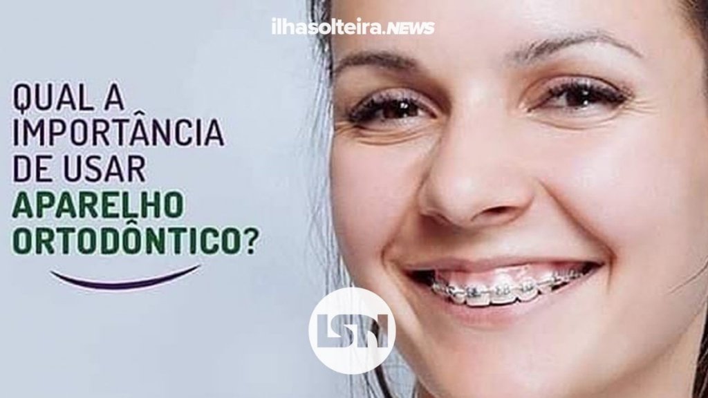 usar-aparelho-ortodontico-gou-odonto-ilha-solteira-news