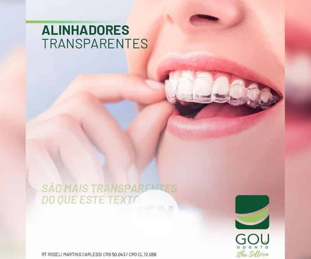 gou-odonto-aparelho-invisivel-ilha-solteira-news