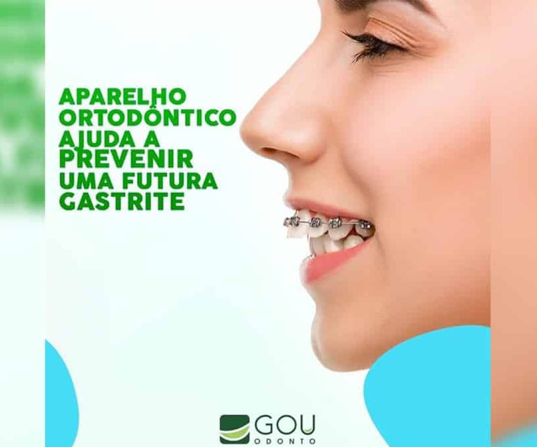 gou-odonto-aparelho-ortodontico-ilha-solteira-news