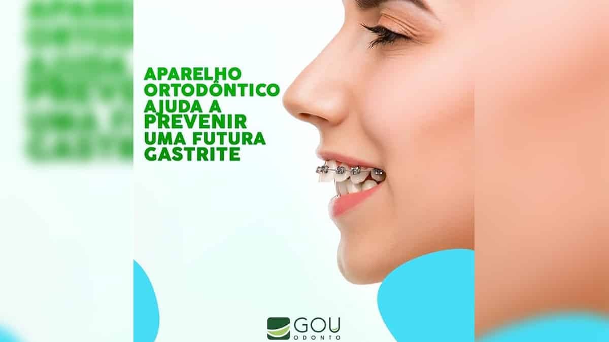 gou-odonto-aparelho-ortodontico-ilha-solteira-news