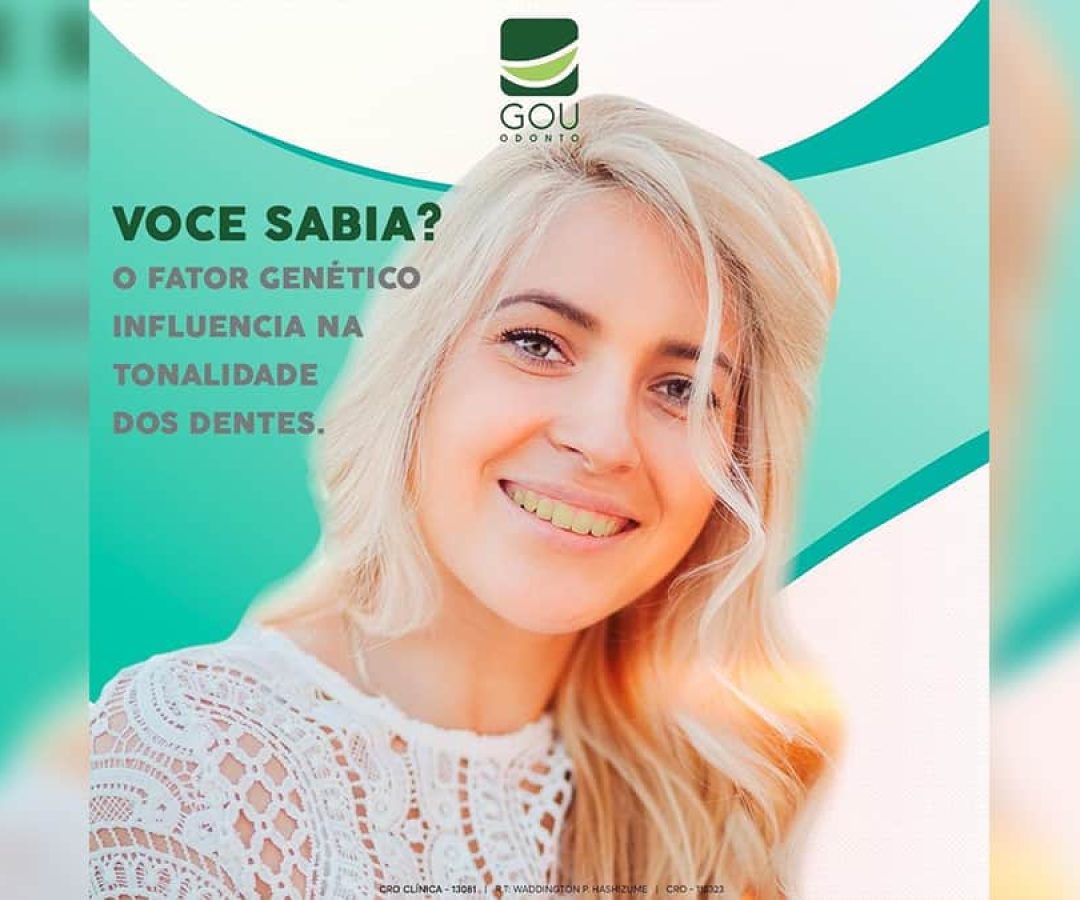 gou-odonto-clareamento-dental-ilha-solteira-news