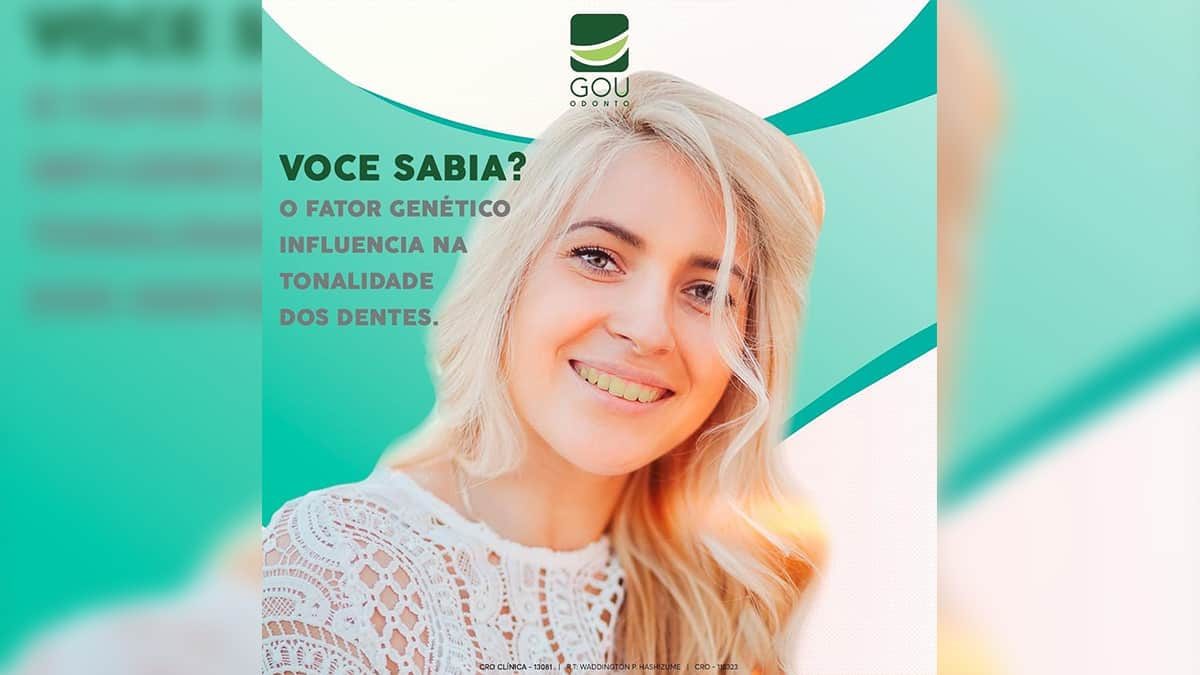 gou-odonto-clareamento-dental-ilha-solteira-news