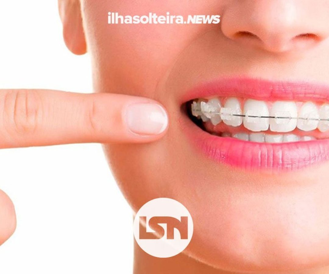 gou-odonto-como-ter-sorriso-perfeito-sem-dores-ilha-solteira-news