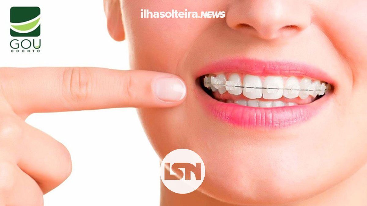 gou-odonto-como-ter-sorriso-perfeito-sem-dores-ilha-solteira-news