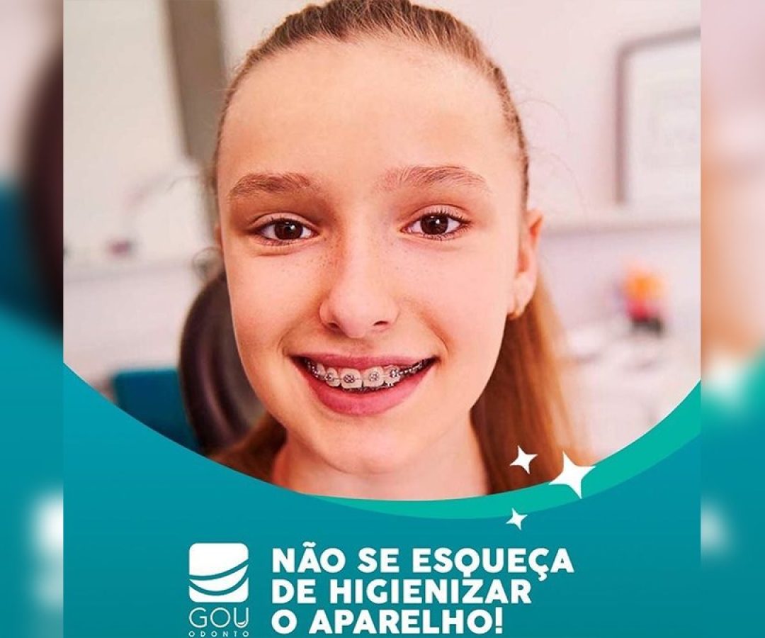gou-odonto-higienizacao-aparelho-ilha-solteira-news gou-odonto-higienizacao-aparelho-ilha-solteira-news