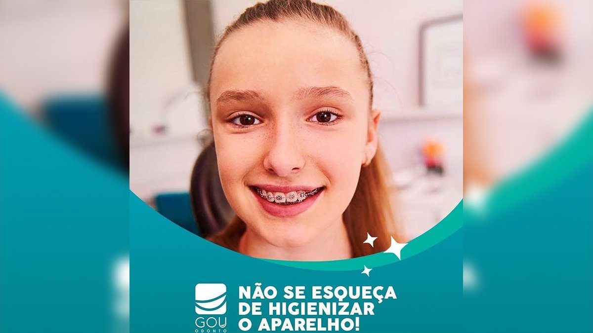 gou-odonto-higienizacao-aparelho-ilha-solteira-news