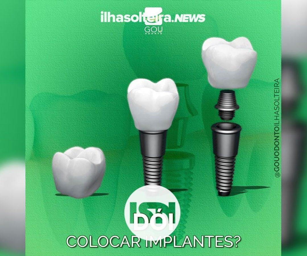 gou-odonto-implante-dentario-ilha-solteira-news gou-odonto-implante-dentario-ilha-solteira-news