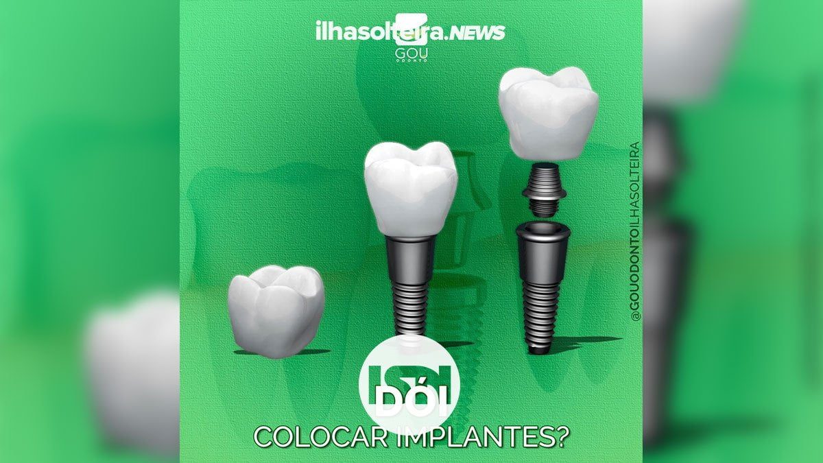 gou-odonto-implante-dentario-ilha-solteira-news