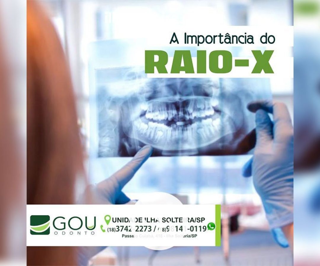 gou-odonto-importancia-raio-x-ilha-solteira-news