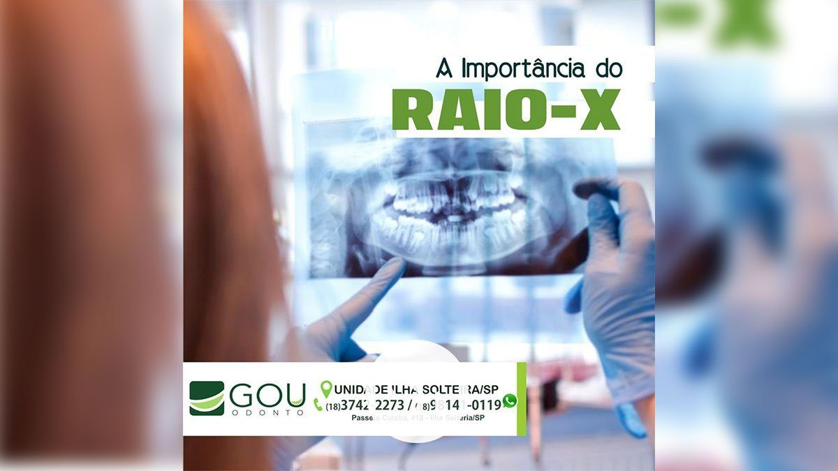gou-odonto-importancia-raio-x-ilha-solteira-news