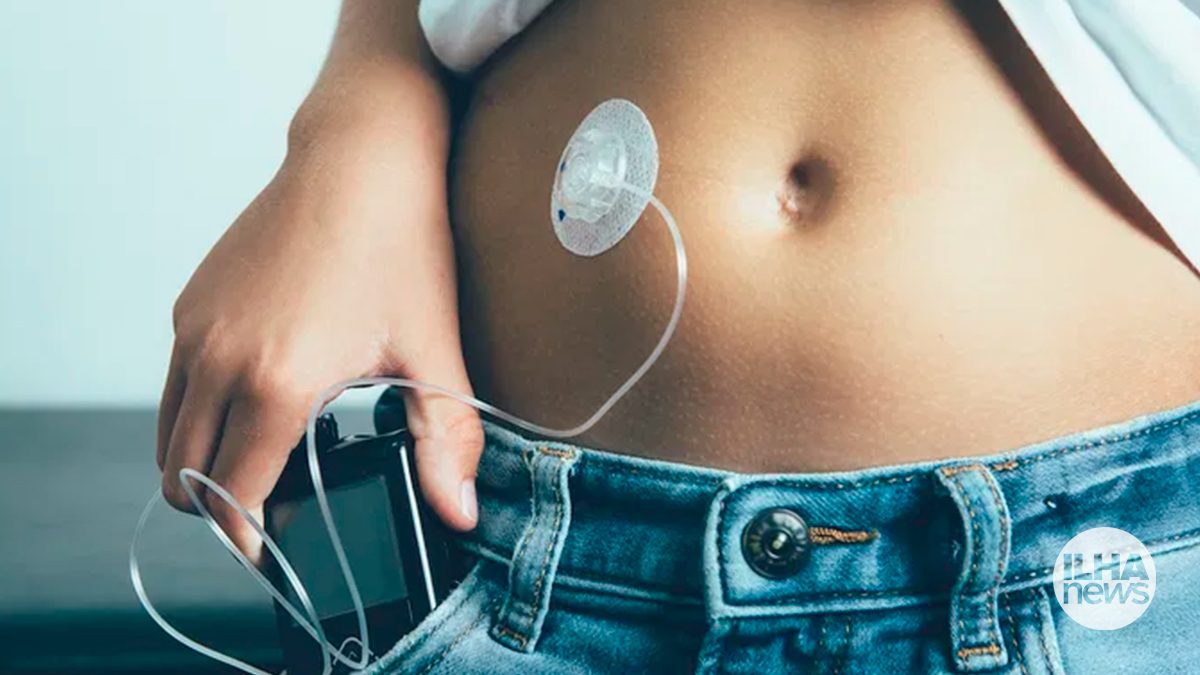 ilha-news-justica-determina-bomba-de-insulina-diabetes-ilha-solteira