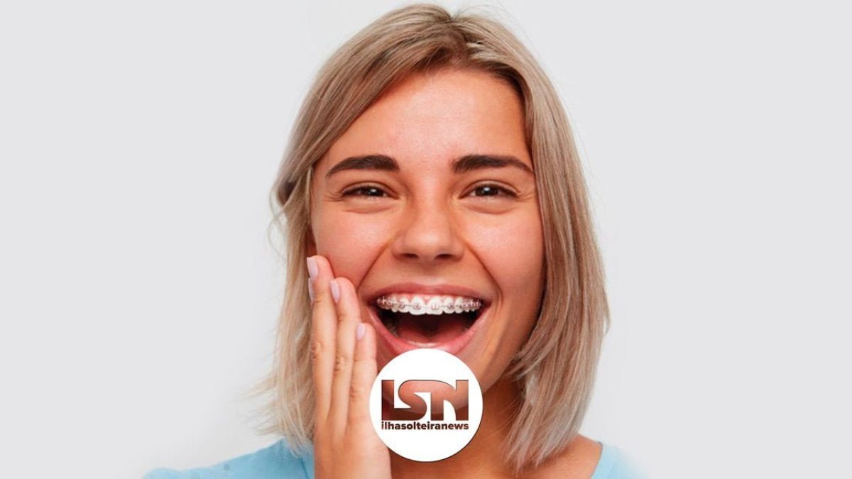 ilha-solteira-news-gou-aparelho-ortodontico-vantagens