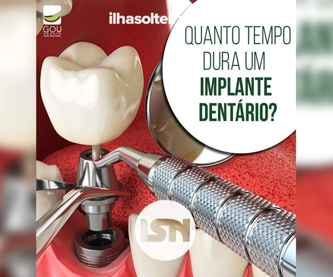 implante-dentario-gou-odonto-ilha-solteira-news
