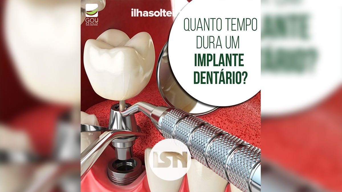 implante-dentario-gou-odonto-ilha-solteira-news