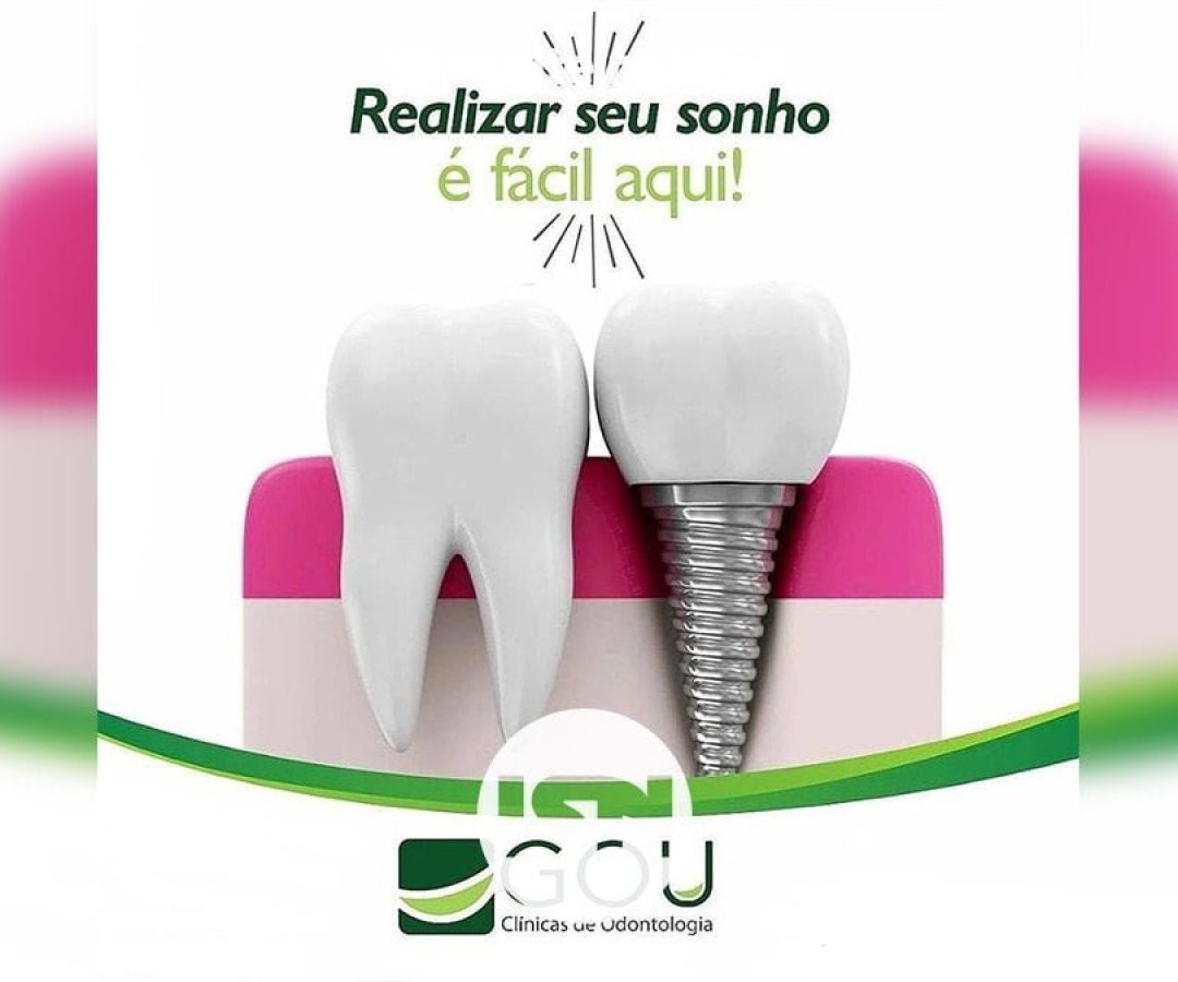 implante-dentario-gou-odonto-ilha-solteira-news