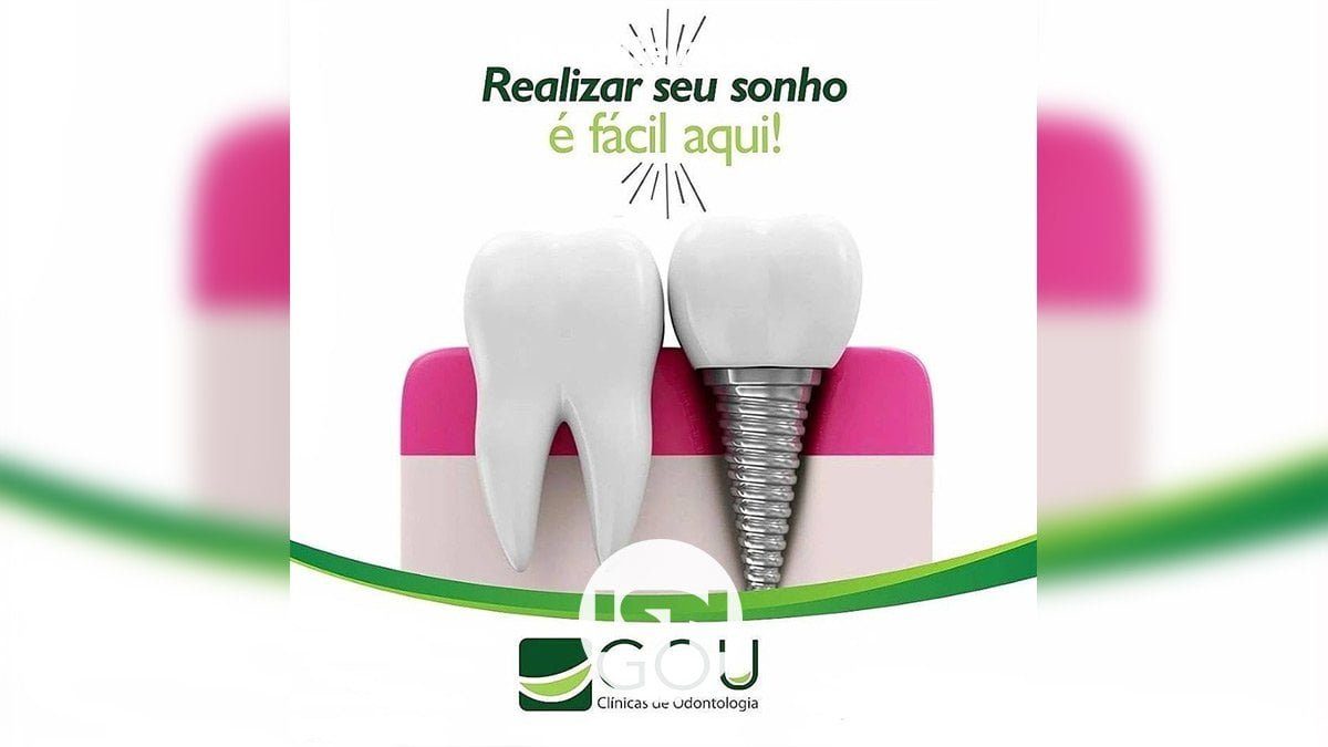 implante-dentario-gou-odonto-ilha-solteira-news