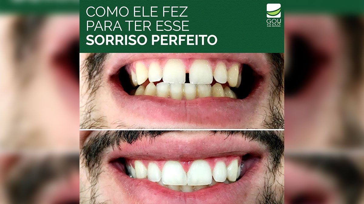 sorriso-perfeito-gou-odonto-ilha-solteira-news