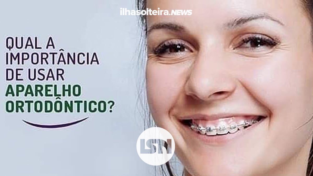 usar-aparelho-ortodontico-gou-odonto-ilha-solteira-news