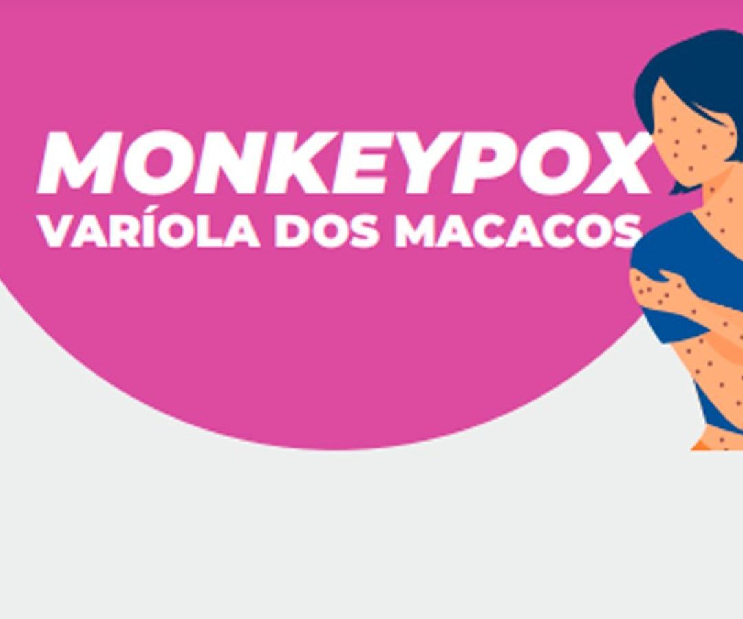 variola-dos-macacos-primeiro-caso-ilha-solteira-news